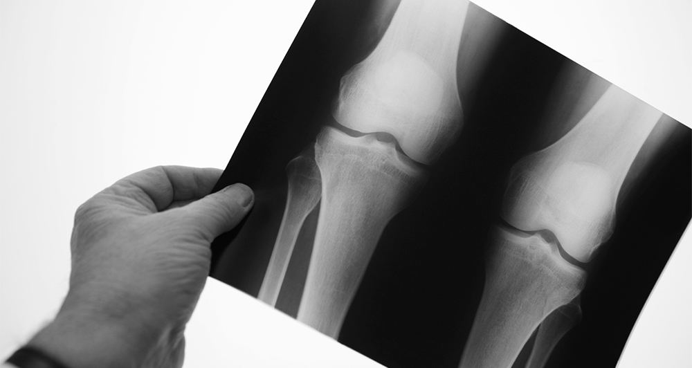 Osteoarthritis Research Group