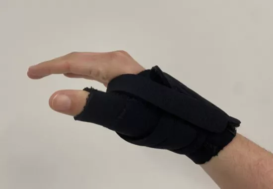 A simple mix of treatments holds the key to better hand function