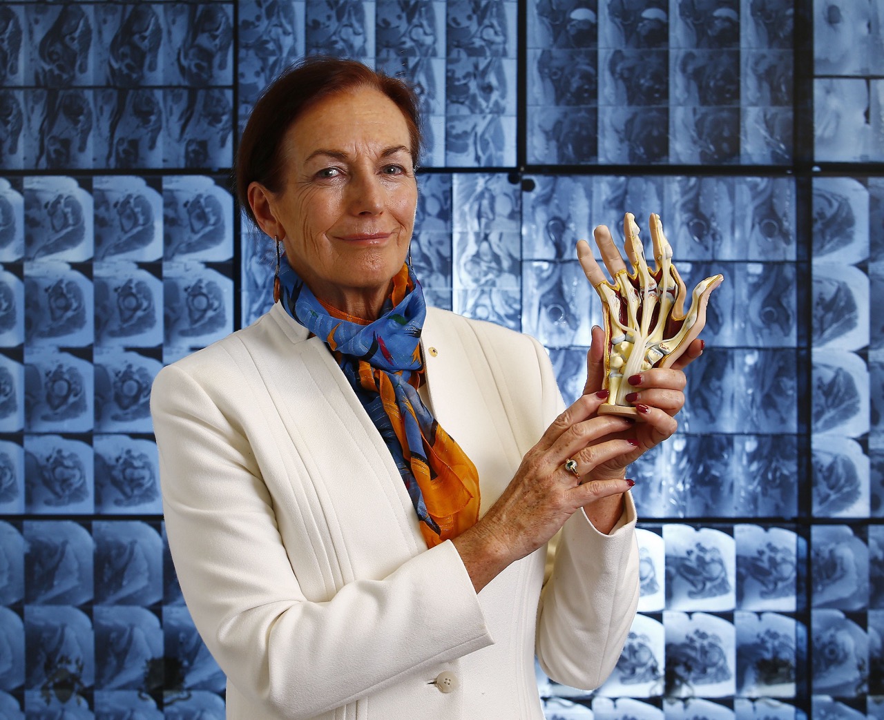 Kolling teams driving world-leading research into arthritis care