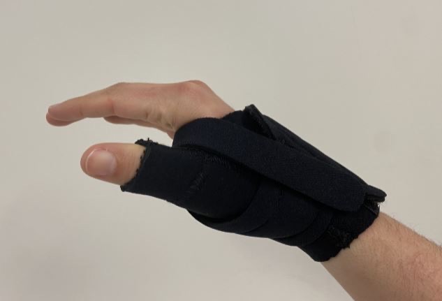 A simple mix of treatments holds the key to better hand function