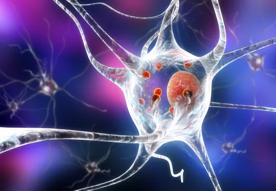 High tech project offers hope for Parkinson’s treatment