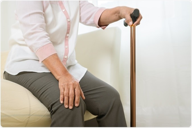 New funding to shift fragmented osteoarthritis care towards prevention, earlier prediction and better outcomes